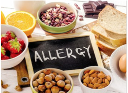 Verschiedene Lebensmittel, die häufig Allergien auslösen, liegen um eine Tafel auf der das Wort ALLERGY mit Kreide geschrieben ist.