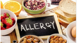 Verschiedene Lebensmittel, die häufig Allergien auslösen, liegen um eine Tafel auf der das Wort ALLERGY mit Kreide geschrieben ist.